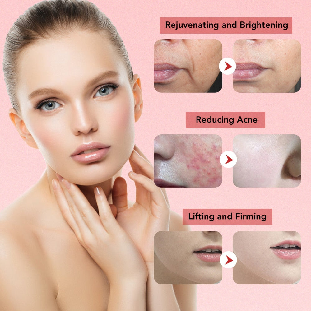LED Facial Massager Skin Rejuvenation,Skin Moisture,Skin Tightening,Facial Clean,Dead Skin Removal,Anti-acne,Blemish Removal,Anti Wrinkle,Whitening,Lifting